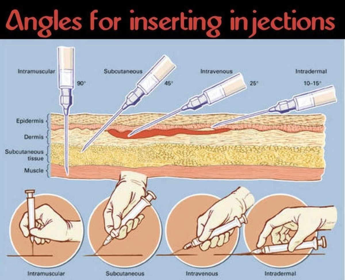 Внутримышечная инъекция как держать шприц